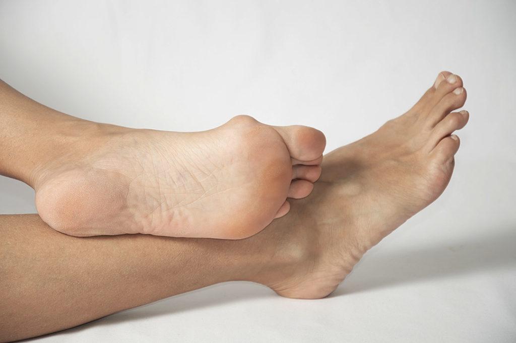 Hallux valgus