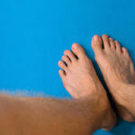 inégalité de longueur des membres inférieurs (ilmi)